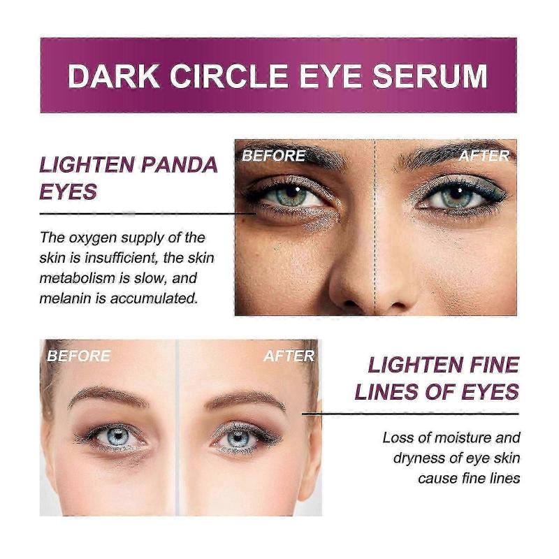 Ouhoe Mango Revitalizing Firming Eye Cream Moisturizes, Anti-Wrinkles, Improves Fine Lines, Diminishes Dark Circles, Moisturizes The Skin Around The E