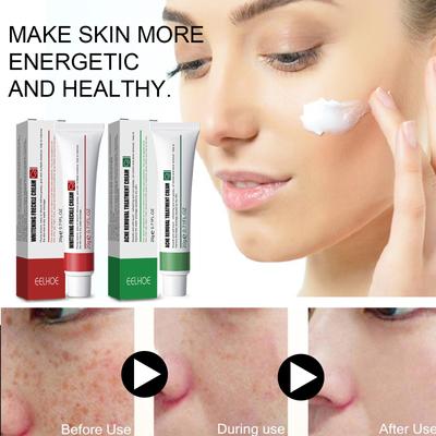 Akne Entfernung Creme Behandlung Akne Narbe Schrumpfen Poren Öl Kontrolle Aufhellung Befeuchten Gesicht Ginseng Kräuter Akne Hautpflege 20g