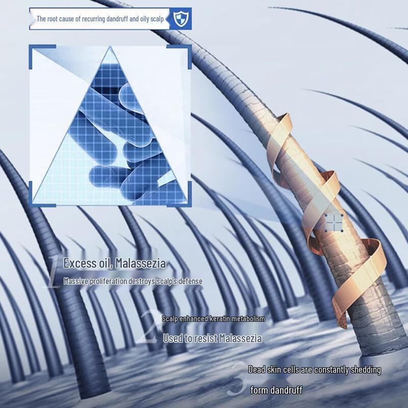 Nanjing Tong Ren Tang Selenium Disulfide Anti-Dandruff Itch Relief Shampoo