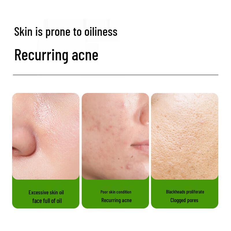 MANTING Mite Cleansing & Acne Control Soap