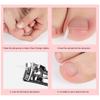 10Pcs Toenail Straightening Ingrown Correction Tool Nail Patch Sticker Foot Care