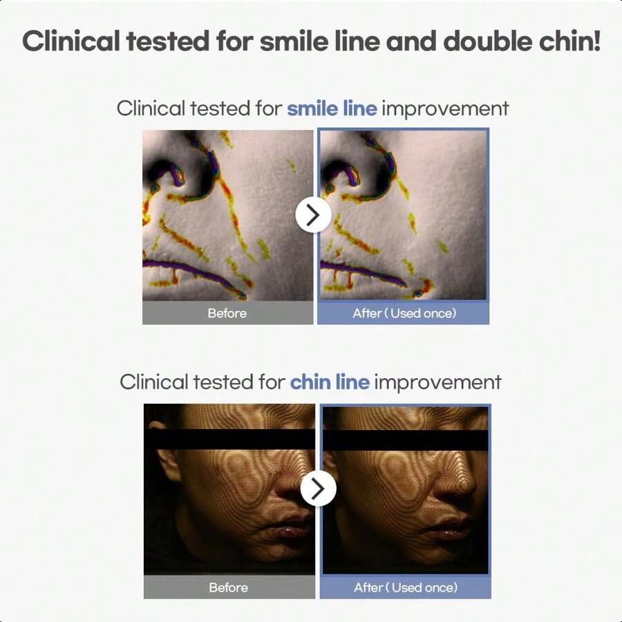 Avajar Rejuvenating Double V Mask(5-Pack)–Advanced Hydrogel Face Lifting Wrap With Centella & Rejubebe, Anti-Aging Tightening V-Line Lifting Mask