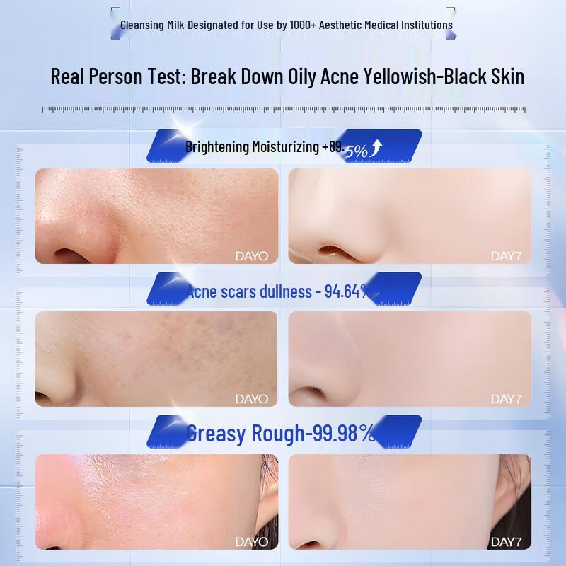 HUAQINGMEI Amino Acid Oil Control Cleanser