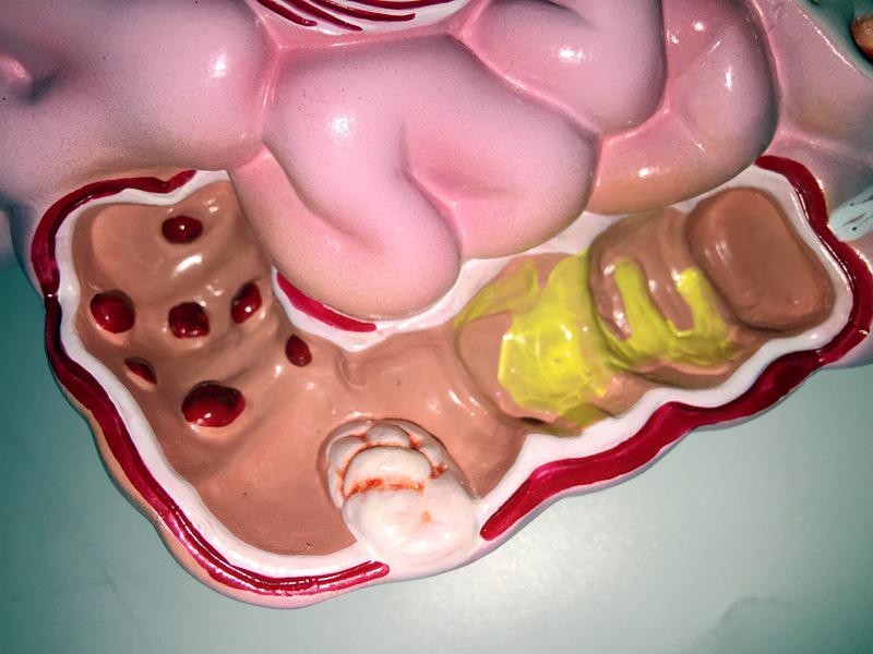 Human Digestive System Model: Large Intestine, Rectum, Duodenum, Stomach & Intestines Anatomical Structure