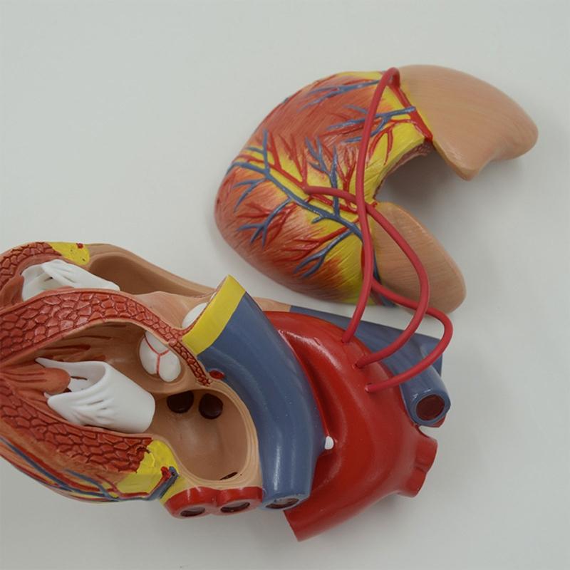 Modello Anatomico di Cuore Umano per Studio Cardiologico che Dimostra il Bypass Cardiaco