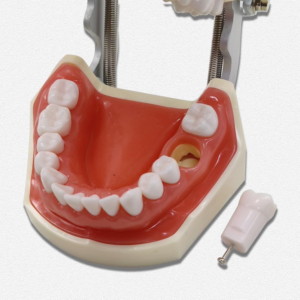 Modèle dentaire dents de gomme modèle d'enseignement modèle de Typodont dentaire Standard démonstration avec modèle de dents amovibles modèles de dentiste