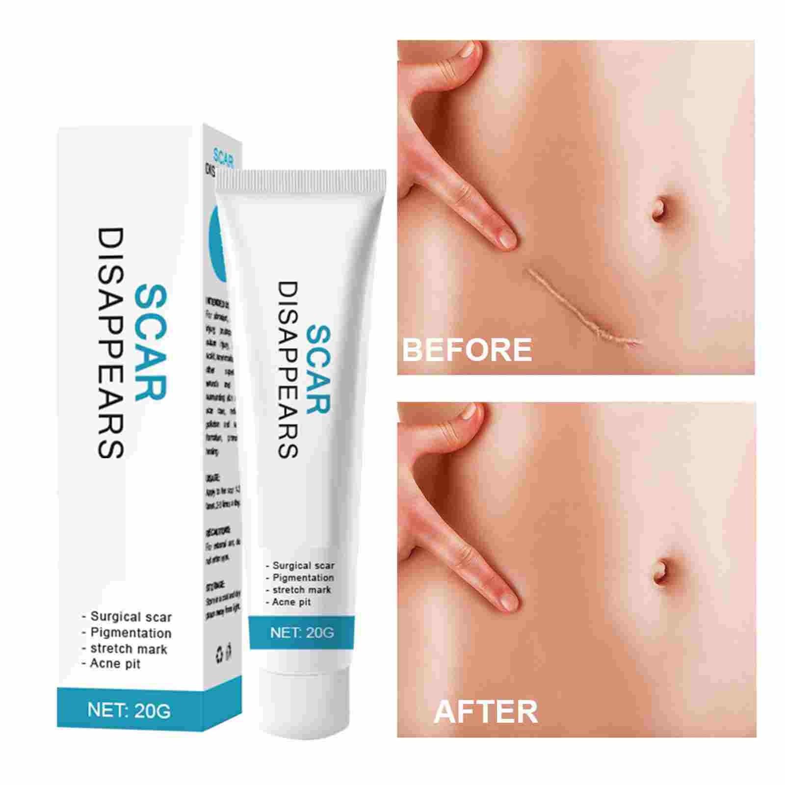 Глубокое отбеливание — фото 2