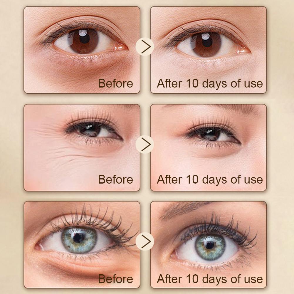 Lotus Seedpod Brass & Rosewood Facial Gua Sha Tool Eye Relaxation Spot Meridians Acupoint Massage Handheld