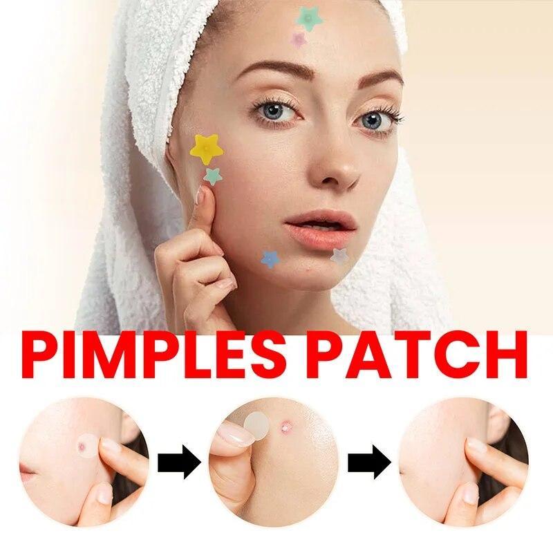 Acne Patch Lighten Acne Spots Repair Skin Blemishes Acne Patch
