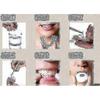 Best Selling In 2024 12-pack Silicone Braces For Nighttime Teeth Grinding Sleep