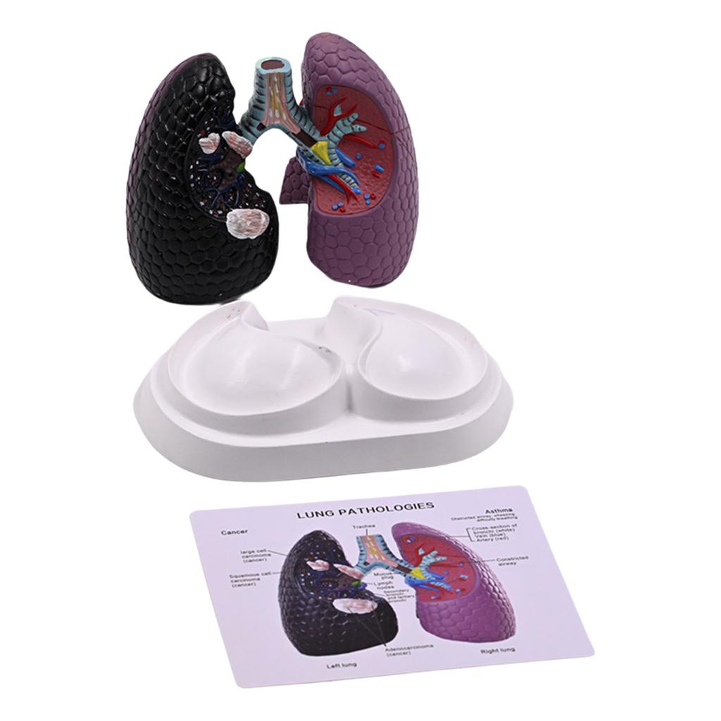Anatomical Pathological Lung Model Human Lung Anatomy Model Normal and Pathological Lung Anatomy Model for Teaching Tool
