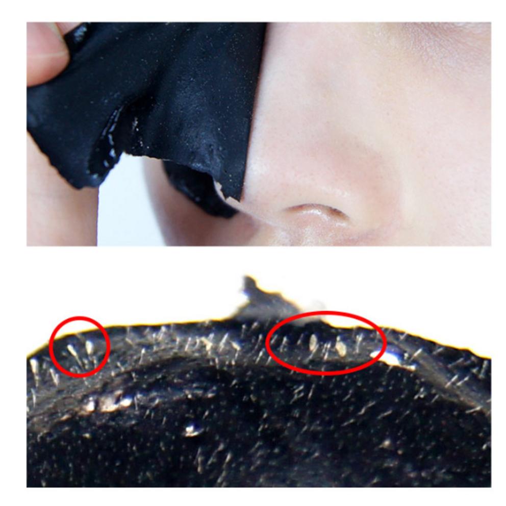 [Lirikos] All Kill Mitesserentferner Nasenmasken-Packung 40ml