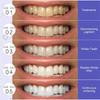 5D Whitening Teeth Stickers Gel Whitening Strips Stain Removal Oral Hygiene Care Strip Dental Bleaching Clean Oral Hygiene Teeth