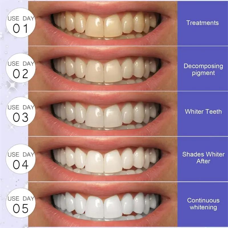 5D Whitening Teeth Stickers Gel Whitening Strips Stain Removal Oral Hygiene Care Strip Dental Bleaching Clean Oral Hygiene Teeth
