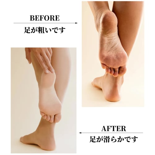 RICISUNG Natural Pumice Stone for Foot Care (Set of 3) - Callus Remover, Pumice Stone, Heel File, Heel Callus Remover, Exfoliating Foot Care Tool for