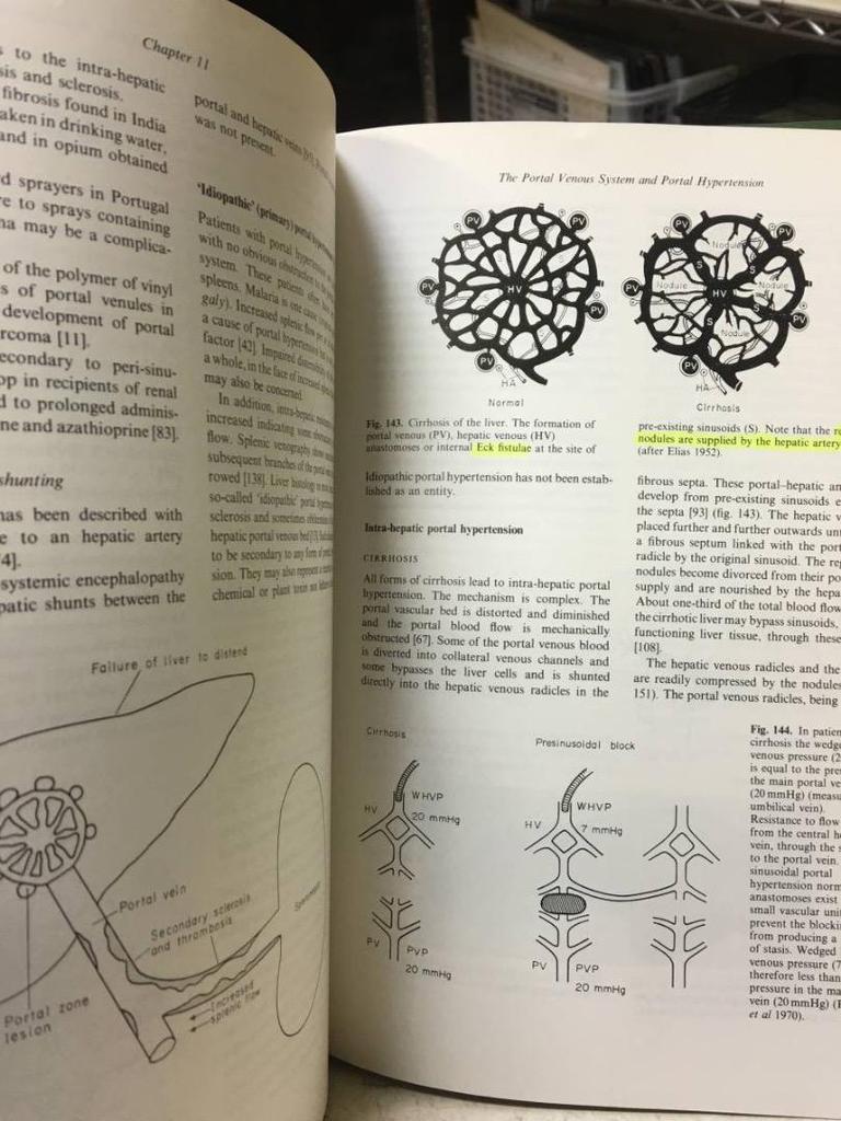 [USED] Diseases of the Liver and Biliary Medical Books