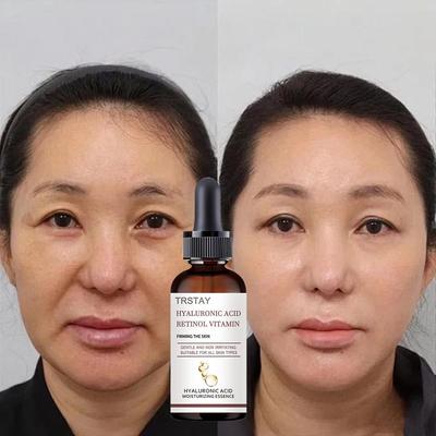 Retinol Sofortiges Gesichtsserum zum Entfernen von Falten, Lifting, Straffung, Anti-Aging, Verblassen von feinen Linien, Aufhellung, koreanische Pflege, kosmetische Schönheit, Gesundheit
