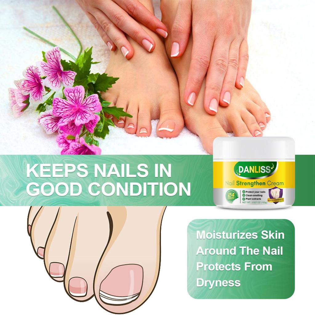 Nail Strengthen Cream- Improve, Discolored Thick Nails and Remove Nail Stains- SOYBEAN,CASTOR OIL, BEESWAX, LAVENDER, LANOLIN, ALOE VERA-100g