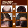 OUHOE Ginger Hair Growth Essence 6ml, Universal Hair Treatment, Moisturizing & Repairing, Strengthens Hair Roots, Anti-Hair Loss