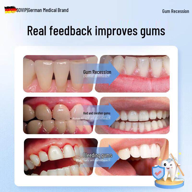 Pastă de dinți SOVIP pentru repararea gingiilor și desensibilizare