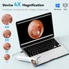 1080P HD Ear Camera 5-in-1 Smart Detector with Screen Ear Scoop Set 6 Replacement Ear Scoops 12 Replacement Check Heads Ear Tool