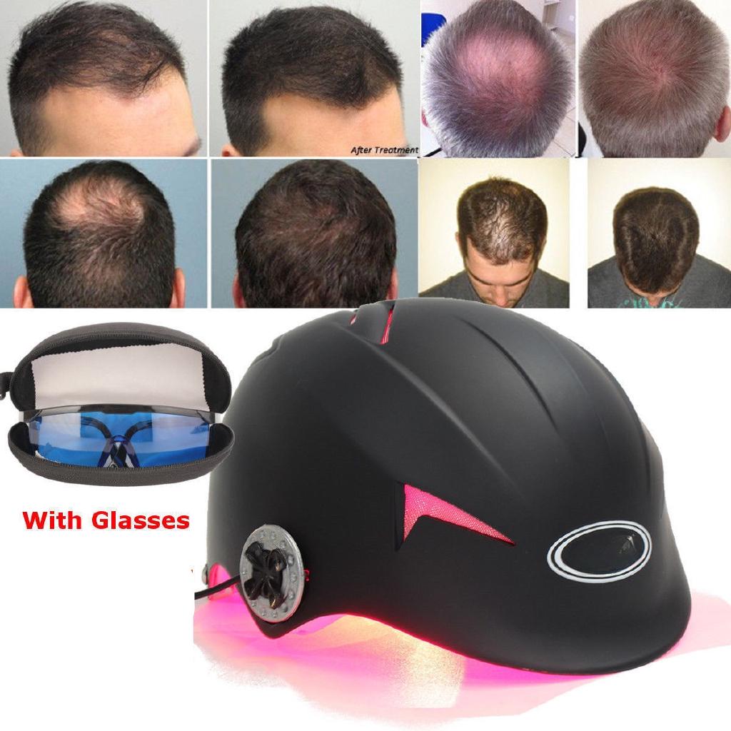 USB Adjustable Hair Regrowth Laser Cap 128 Diodes Hair Fast Regrowth Machine with Free Glasses New Black Helmet Hair Loss Upgrate Therapy Laser