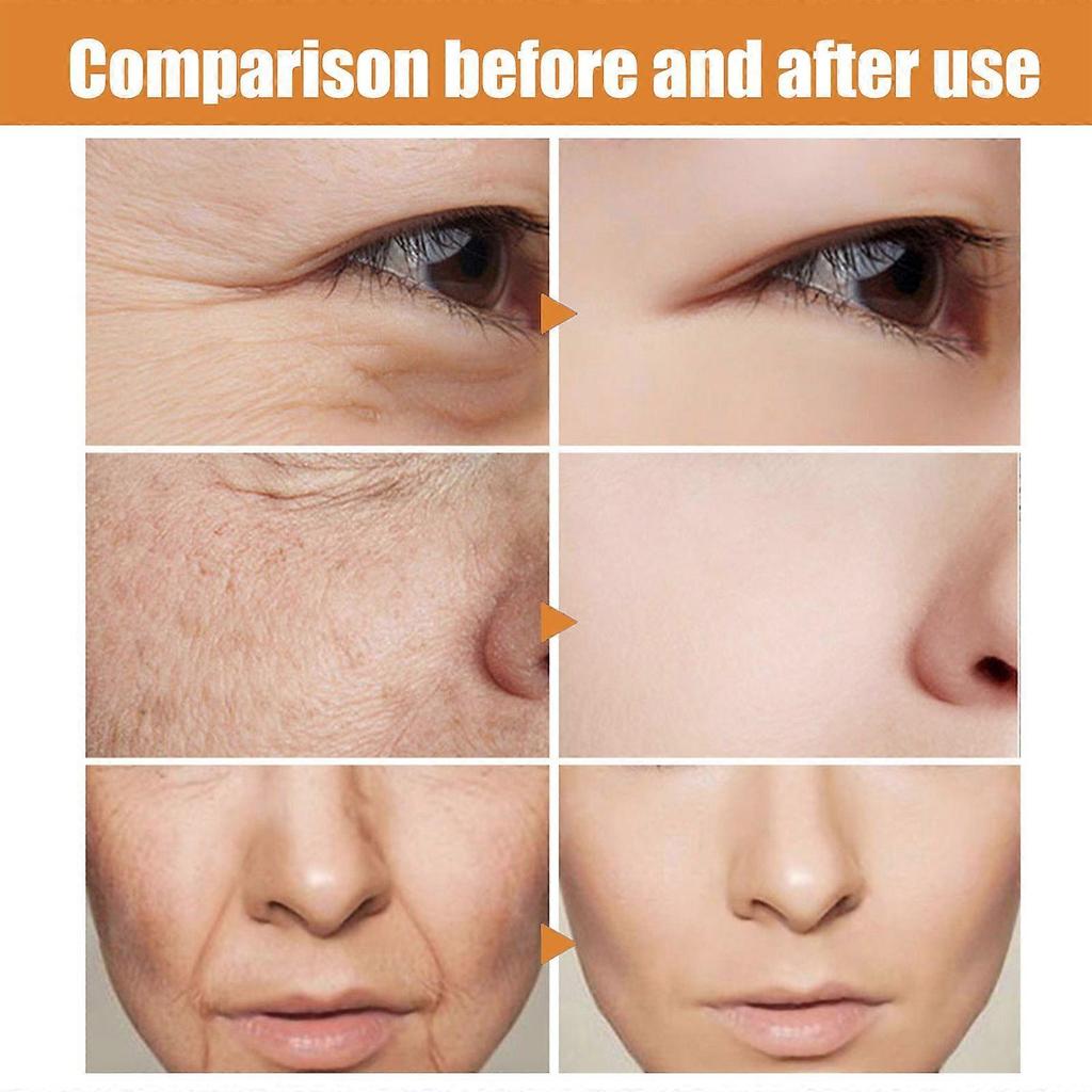 Limited time!!Eelhoe Vitamin C Collagen Facial Serum Hydrating And Moisturizing Smooth Day And Night Water-Like Facial Serum