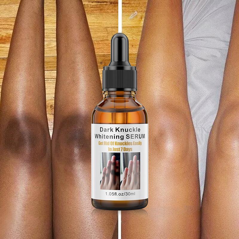 Joint Darkening Serum Brightening Essence for Body, Knee, Hand, and Joints