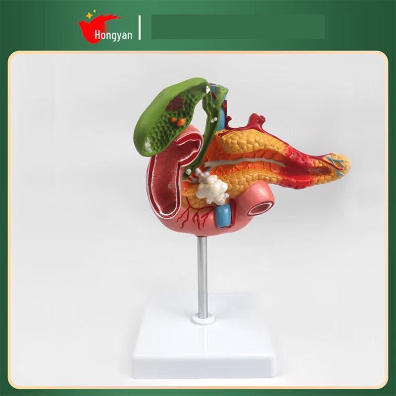 Human Pancreas Duodenum Gallbladder Pathology Teaching Model