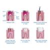 120 ks Zubní šroubové čepy Čistý titan Pozlacená úprava Implantátový jádro Kuželový šroubový čep S/M/L Závitový hřebík Fixace zubů