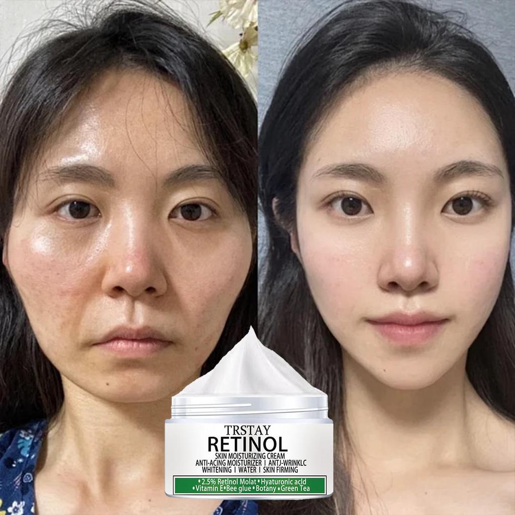 Hyaluronic Acid Shrinks Pores Face Cream Collagen Whitening Moisturizing Anti-wrinkle Anti-aging Remove Dark Spots Korean Care