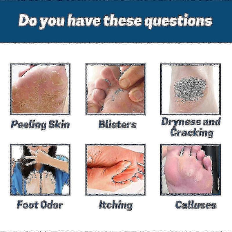 BestsellerFußpilz-Spray, Fußspray in Pflegequalität, Fußpilz