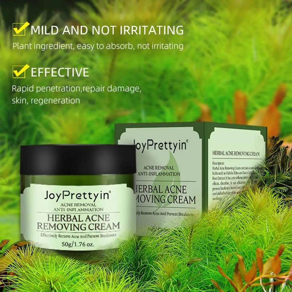 Crème anti-acné pour le visage, élimine les pores dilatés, traite l'acné, contrôle du sébum, réduit les pores, crème pour le visage, soins de la peau, beauté et santé