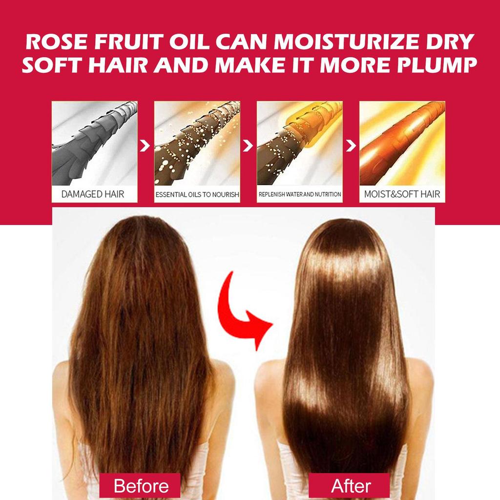 EELHOE Rosehip Oil 30ml: Reduces fine lines, brightens and whitens, fades dark spots, deeply moisturizes, and softens hair. A skin and hair care oil.