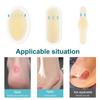 24Pcs Adhesive Hydrocolloid Gel Blister Plaster Heel Anti-Wearing Heel Sticker Pedicure Patch Plaster Foot Care Tools