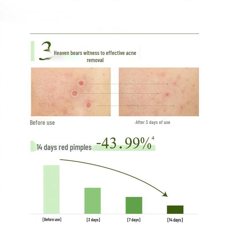 Pond's Acne Clear Facial Cleanser Gel with Water Mint