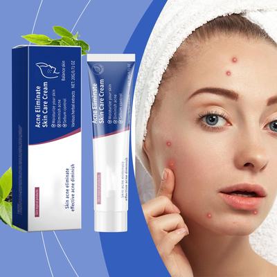 Περιποίηση προσώπου – Προιόντα για την ακμή