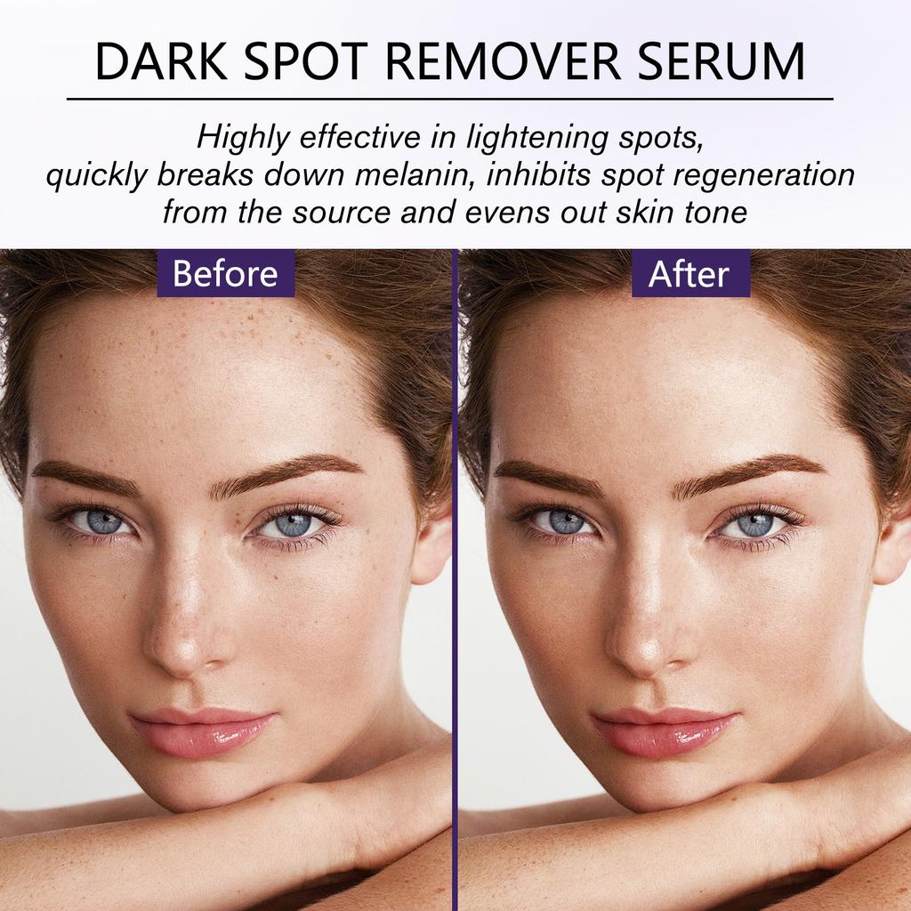 Bright Face Dot Serum Stop Freckle Balm Hydrating And Whitening Serum With Whitening Motherwort Tannic Damascus Rose 50ml