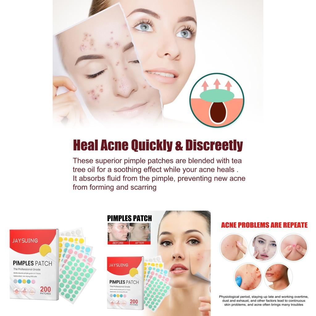 Jaysuing Colorful Acne Patches For Effective Spot Treatment And Scar Reduction 200pcs