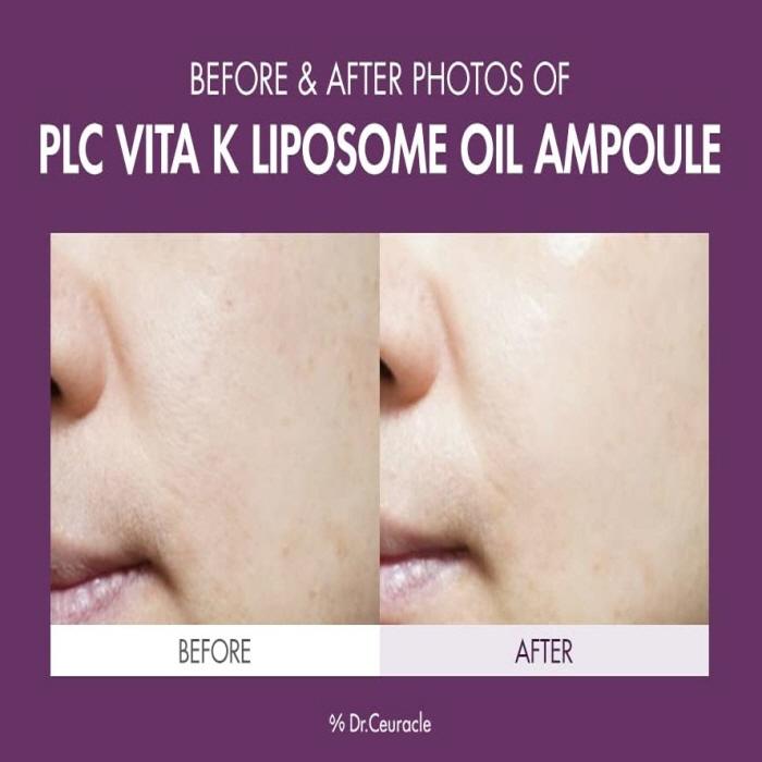 Dr.Ceuracle PLC Vita K Liposome Oil Ampoule 50ml
