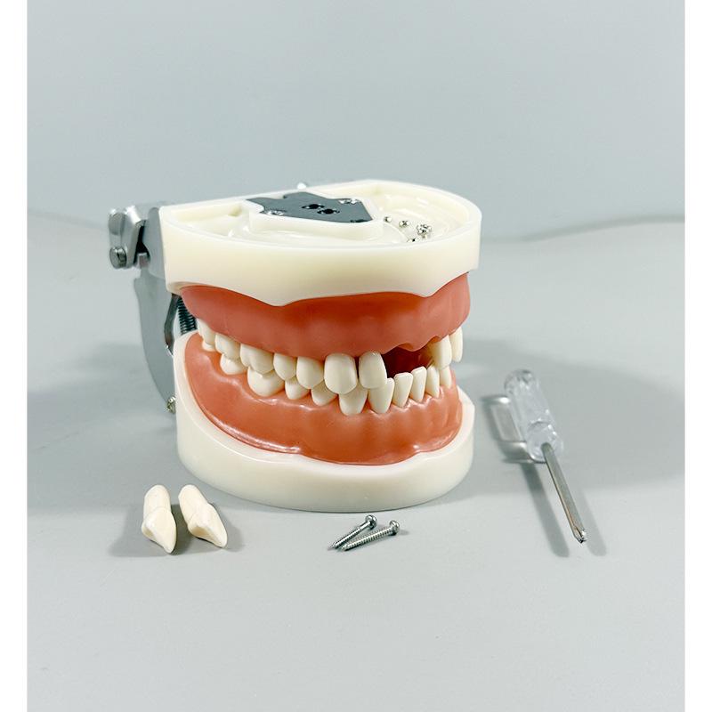 Прозора Знімна Повна Модель Щелепи з М'якими Яснами та Зубами для Підготовки до Імплантації