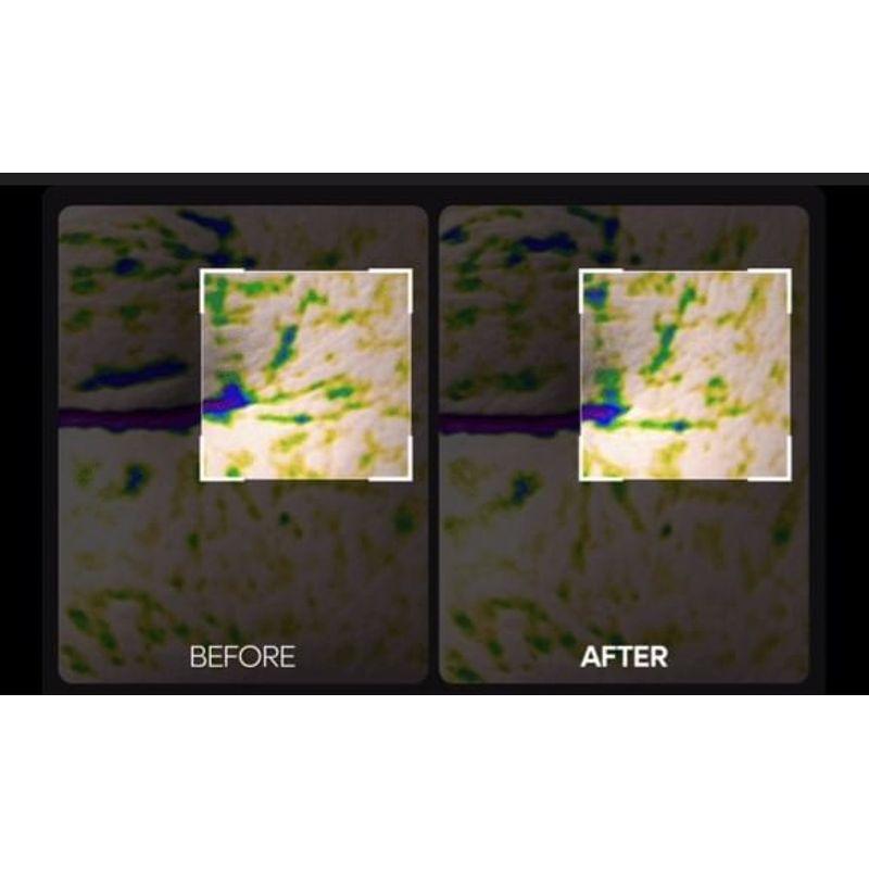 Dr.Melaxin Facephalt Tightening Cream