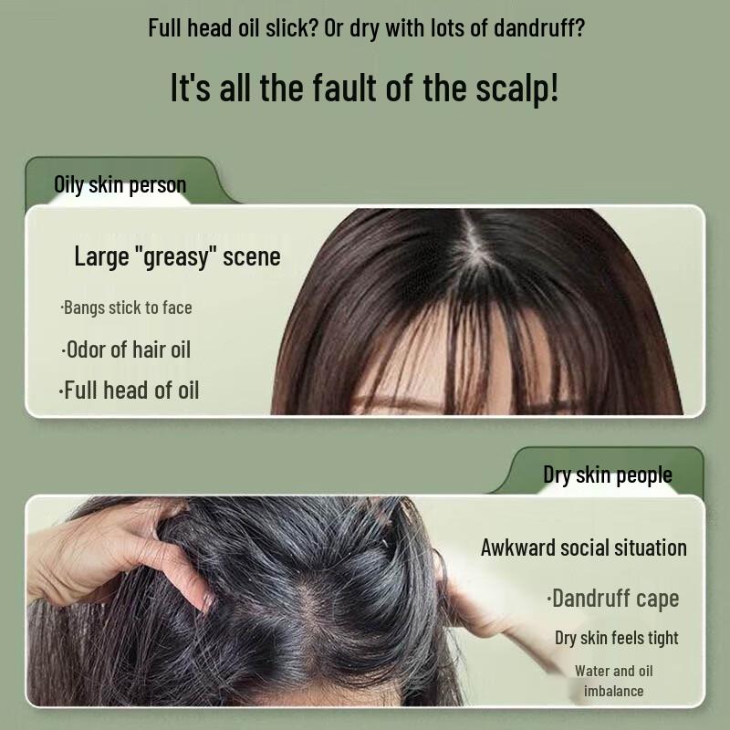 Schwarzkopf Ginger Essence Repair Scalp Soothing Shampoo