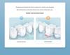Portable Waterproof Smart Electric Tooth Cleaner for Oral Calculus Removal