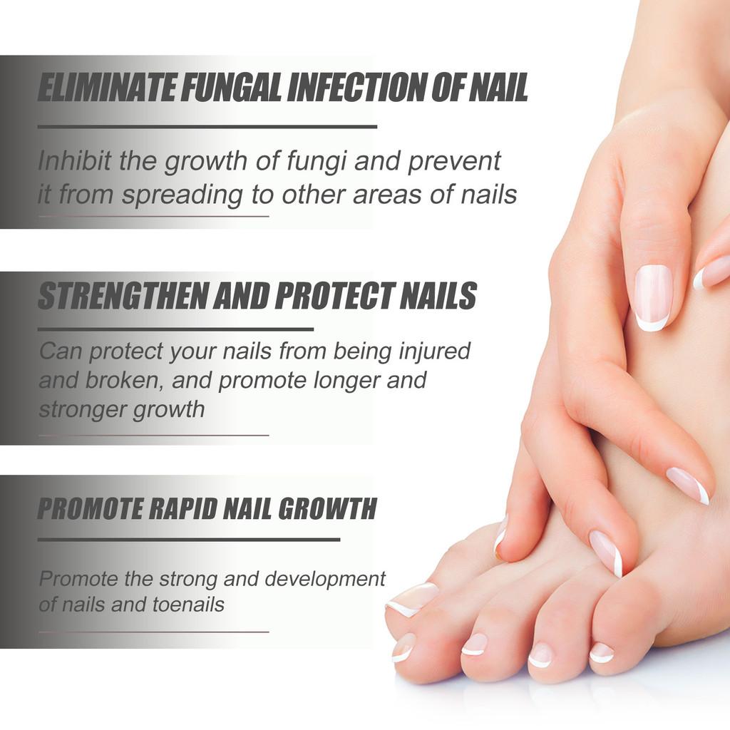 South Moon Nail Repair Serum Nourishing Nail Conditioner For Healthy And Glossy Nails