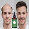 Natural Extract Baldness Repair Spray Hair Regrowth Lotion Haircare Hair Loss Oil
