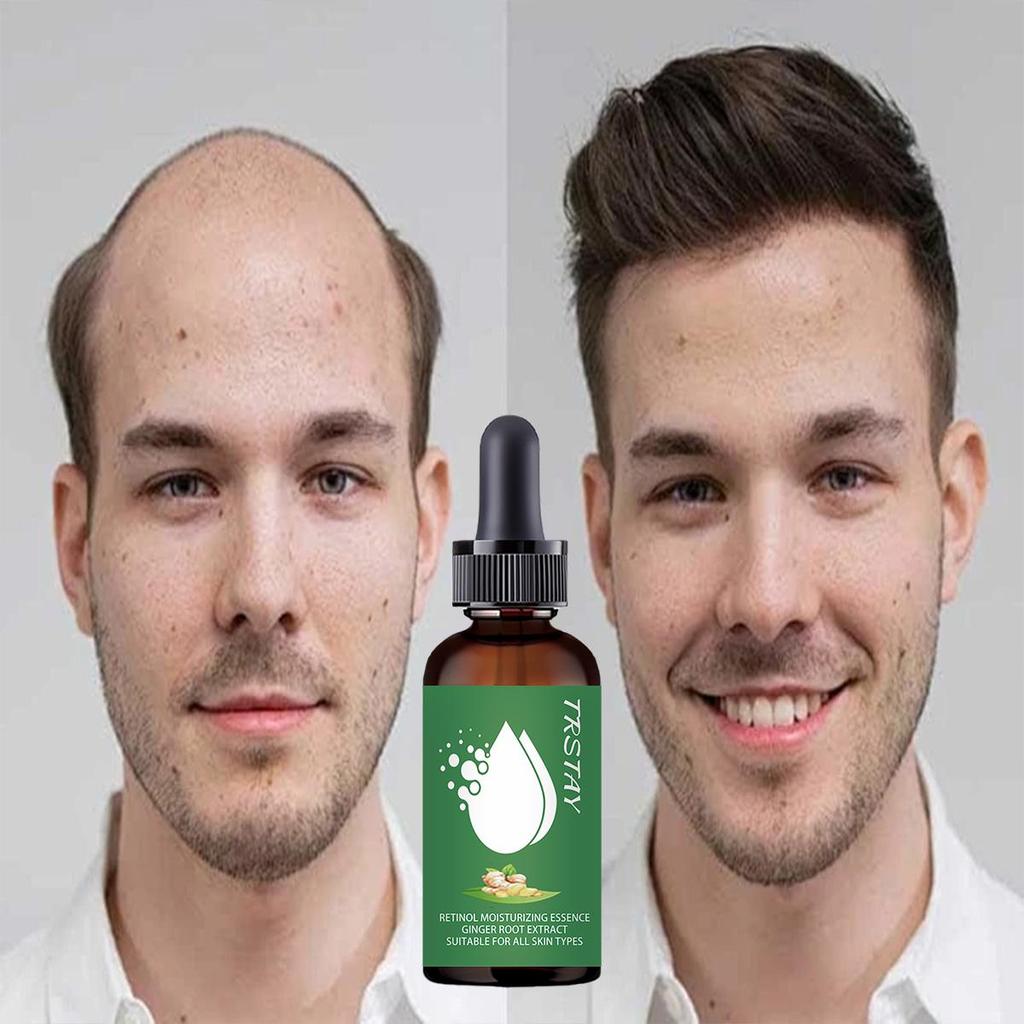 Natural Extract Baldness Repair Spray Hair Regrowth Lotion Haircare Hair Loss Oil