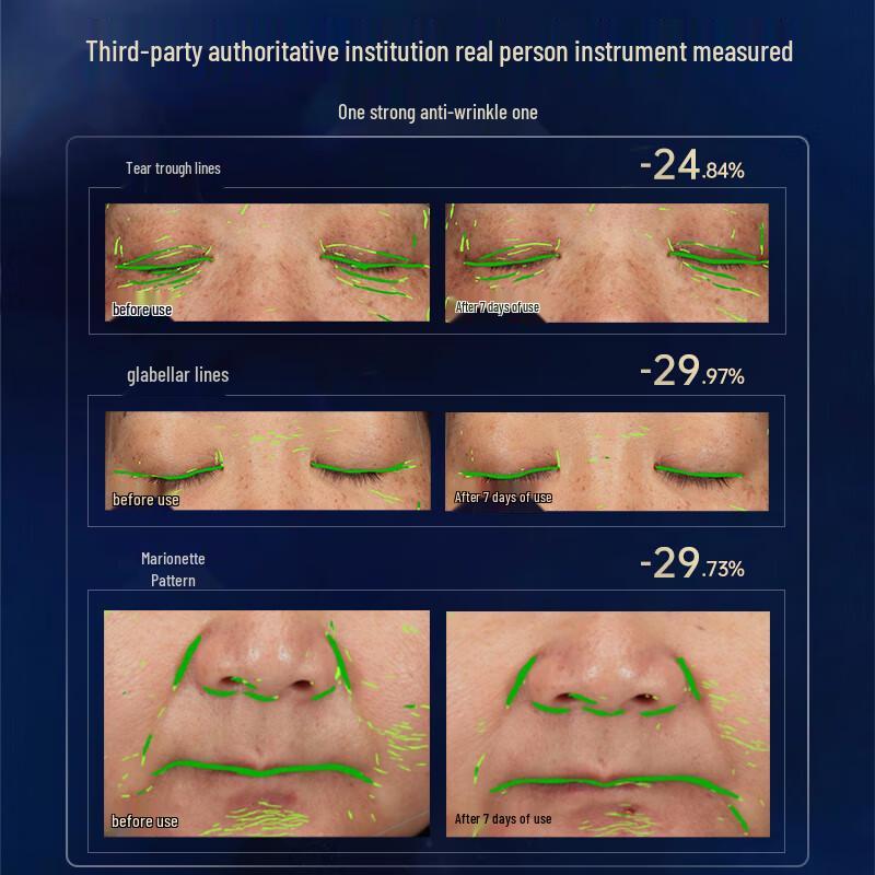 Yi Ting Multi-Peptide Anti-Aging Repair Serum