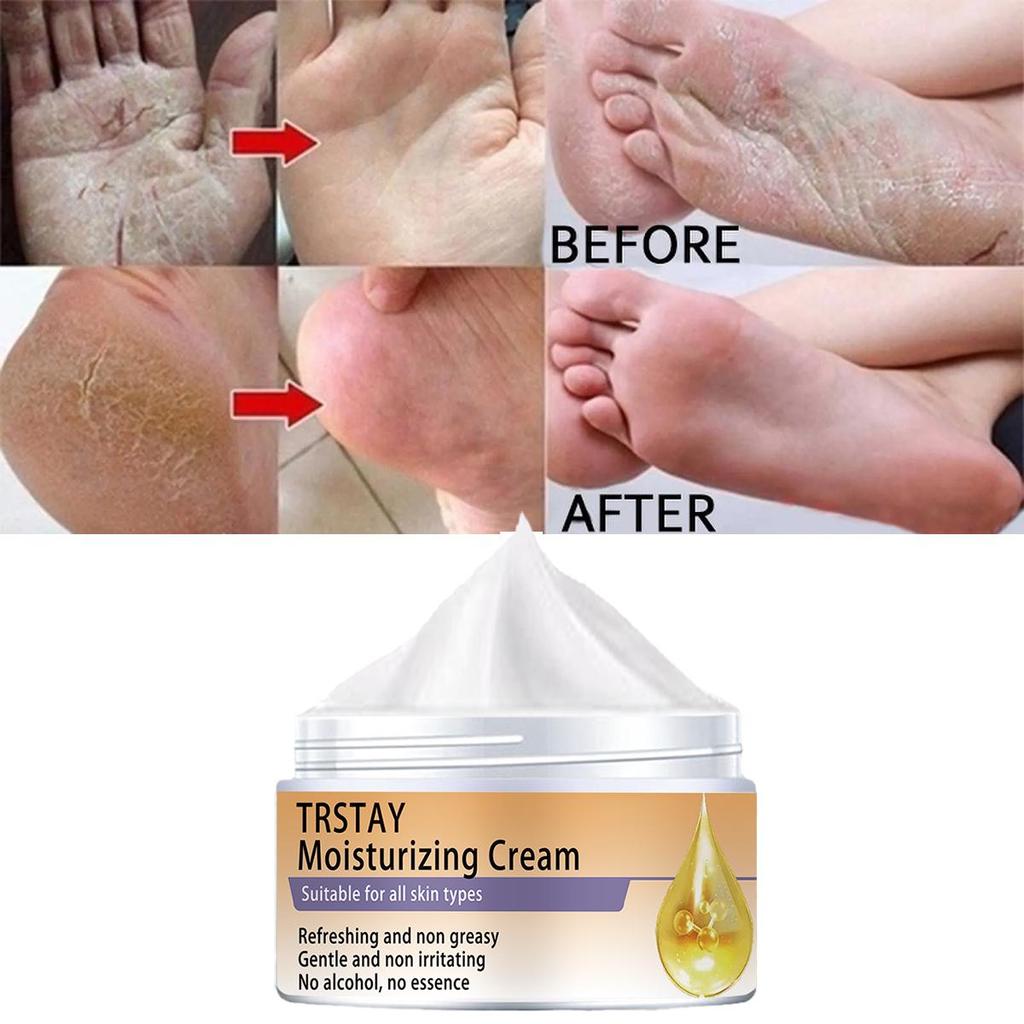 Fotfuktighetskrem lysner opp hudtonen, fukter, letter matthet og strammer opp huden