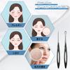 Stainless Steel Acne Needles for Blackhead Pore Acne Blackhead Dedicated Pore Care Beauty Set Removal, Care, Removal, Removal, Portable, Kit, Tool,